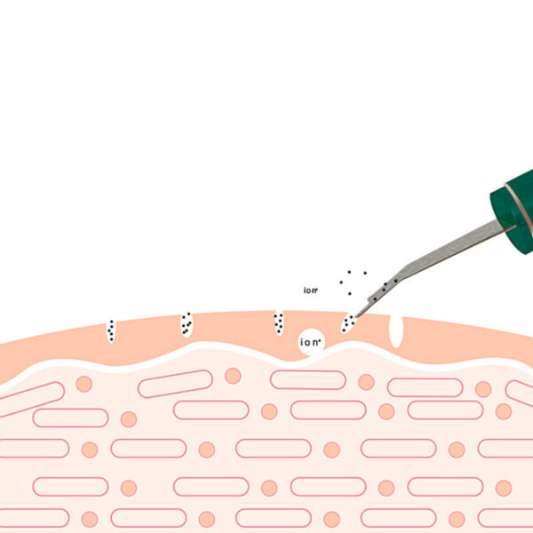 Ultrasonic Skin Rejuvenation Whitening Shoveling Machine Exfoliating Skin Care - Image 7